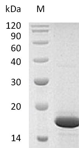 SDS-PAGE