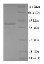 SDS-PAGE