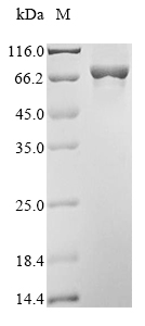 SDS-PAGE