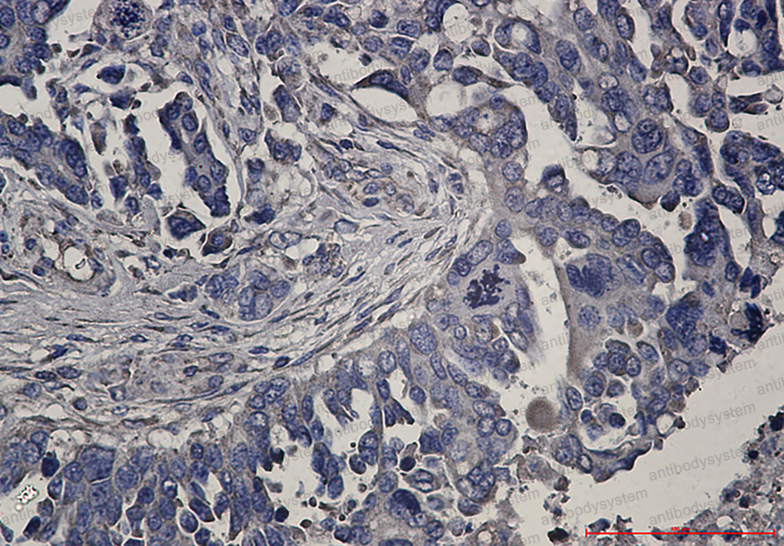 Валидация AntibodySystem RHK51501