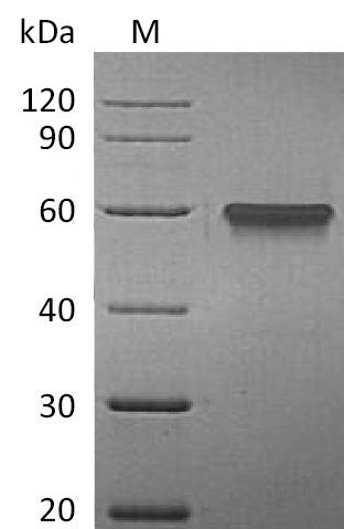 SDS-PAGE