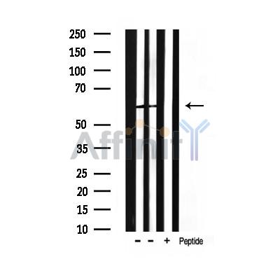 Валидация Affinity AF3470 - 1988