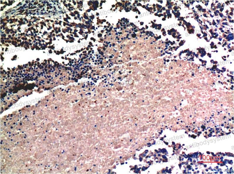 Валидация AntibodySystem RHD96513 (1882)