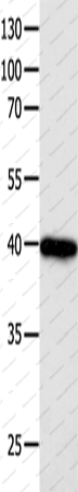 Вестерн-блоттинг, FOXL1, клетки 293T