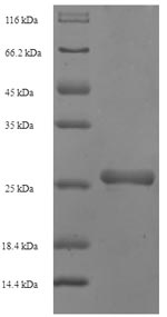 SDS-PAGE