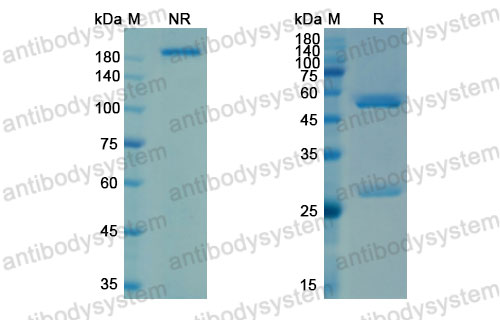Валидация SDS-PAGE - AntibodySystem DHJ89801