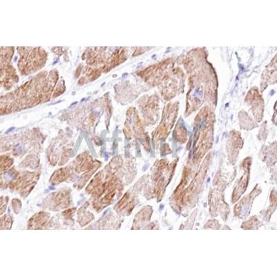 Валидация Affinity DF12945 - 7705