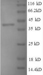 SDS-PAGE