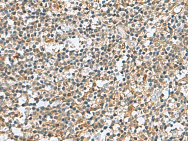 Иммуногистохимия, DNPH1, ткань миндалин человека