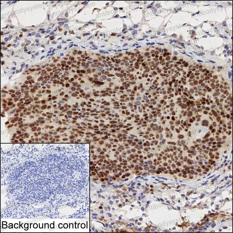 Валидация AntibodySystem RHA12202
