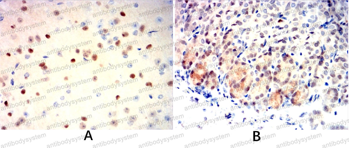 Валидация AntibodySystem RHE57501 (2225)