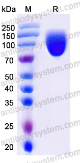 AHJ40401, SDS-PAGE