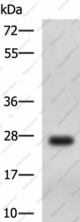 Вестерн-блоттинг, DHRS2, клетки MCF7