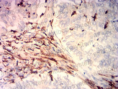 Валидация AntibodySystem RHC33701 (916)