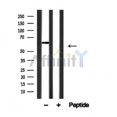 Валидация Affinity AF4605 - 2217