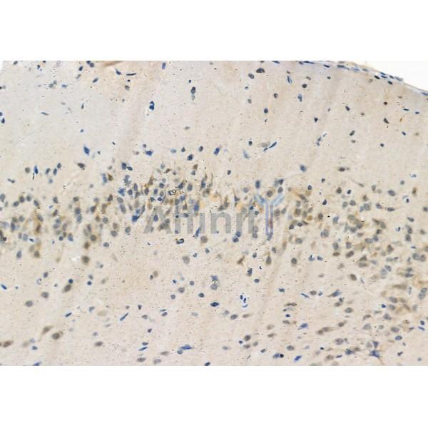 Валидация Affinity DF3185 - 13993