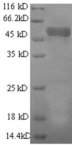 SDS-PAGE