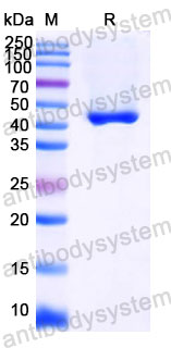 Валидация SDS-PAGE - AntibodySystem RVV08901