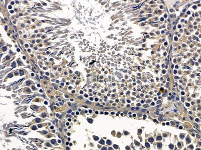 Валидация Affinity DF9200 - 21587