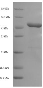 SDS-PAGE