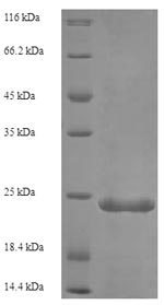 SDS-PAGE