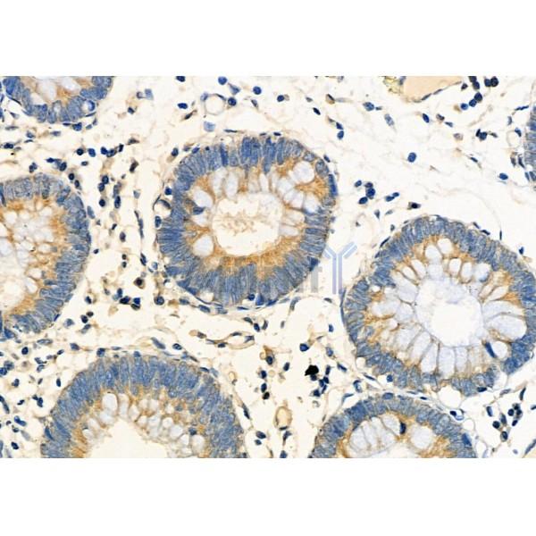 Валидация Affinity DF12379 - 6844