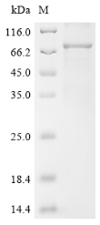 SDS-PAGE