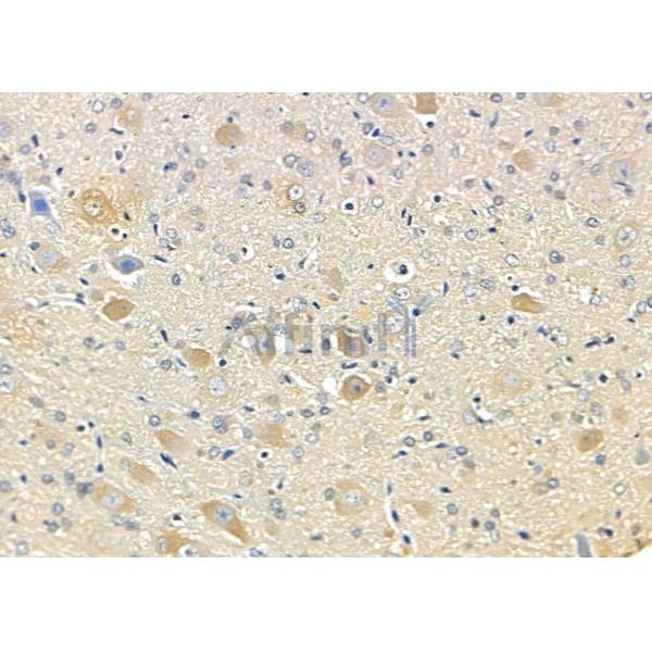 Валидация Affinity DF8793 - 20827