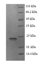 SDS-PAGE