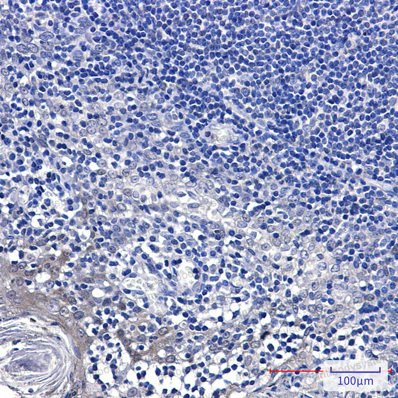 Валидация AntibodySystem RHE58303