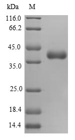 SDS-PAGE
