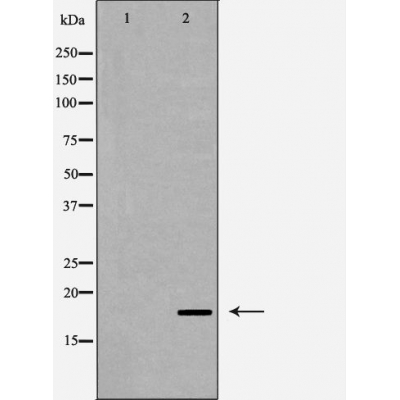 Валидация Affinity AF5381 - 3009