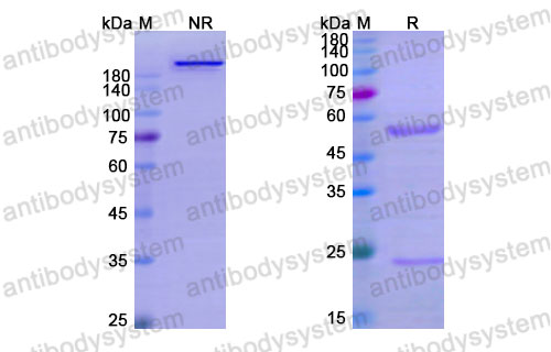 Валидация SDS-PAGE - AntibodySystem DHC02001