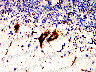 Валидация AntibodySystem RHC87702