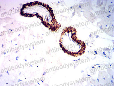 Валидация AntibodySystem RHD80703 (1829)