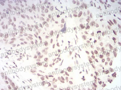 Валидация AntibodySystem RHA28703 (85)