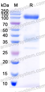 AHD61401, SDS-PAGE
