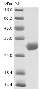 SDS-PAGE