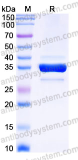 AHJ26302, SDS-PAGE