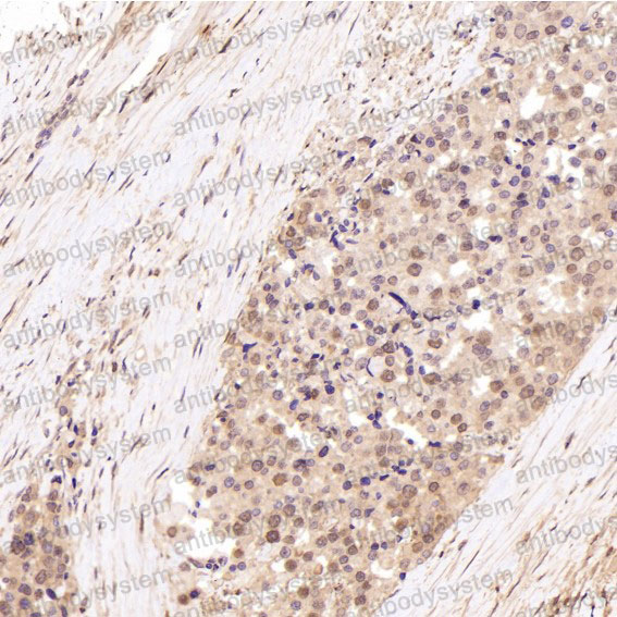 Валидация AntibodySystem RHC69301 (1059)