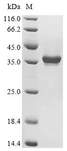 SDS-PAGE
