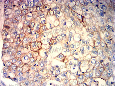 Валидация AntibodySystem RHM00304 (3760)