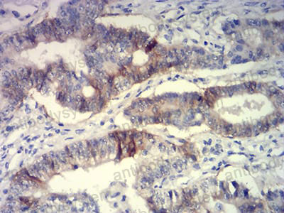 Валидация AntibodySystem RHE79002 (2329)