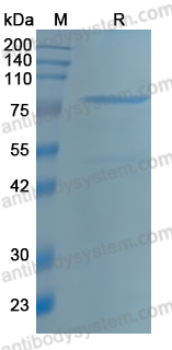 YHH10201, SDS-PAGE