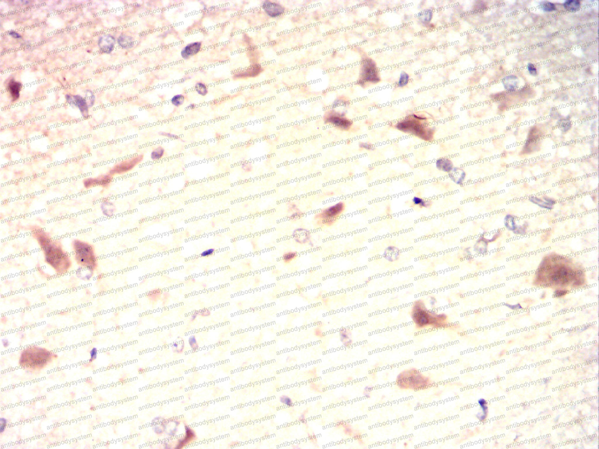 Валидация AntibodySystem RHD71002 (1747)