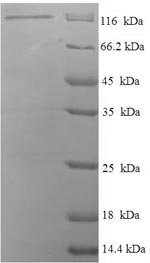 SDS-PAGE