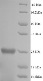 SDS-PAGE