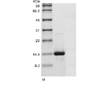 SDS-PAGE