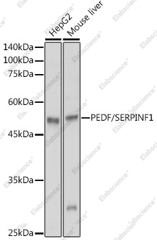 Вестерн-блоттинг, PEDF/SERPINF1, различные клеточные линии
