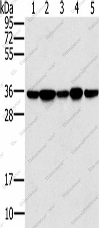 Вестерн-блоттинг, PPP1CC, клетки Jurkat, 293T, HeLa, K562 и ткань мозга мыши
